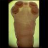 tsaginata_scolex01.jpg