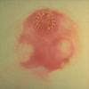 tsolium_scolex.jpg