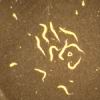 E_vermicularis.jpg