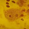 entamoeba_histolytica_tropho.jpg