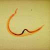 scistosoma02.jpg